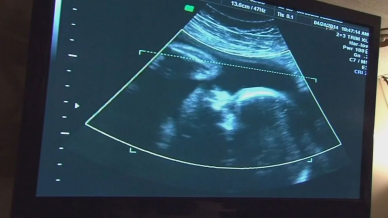 South Carolina’s maternal mortality disparities highlighted